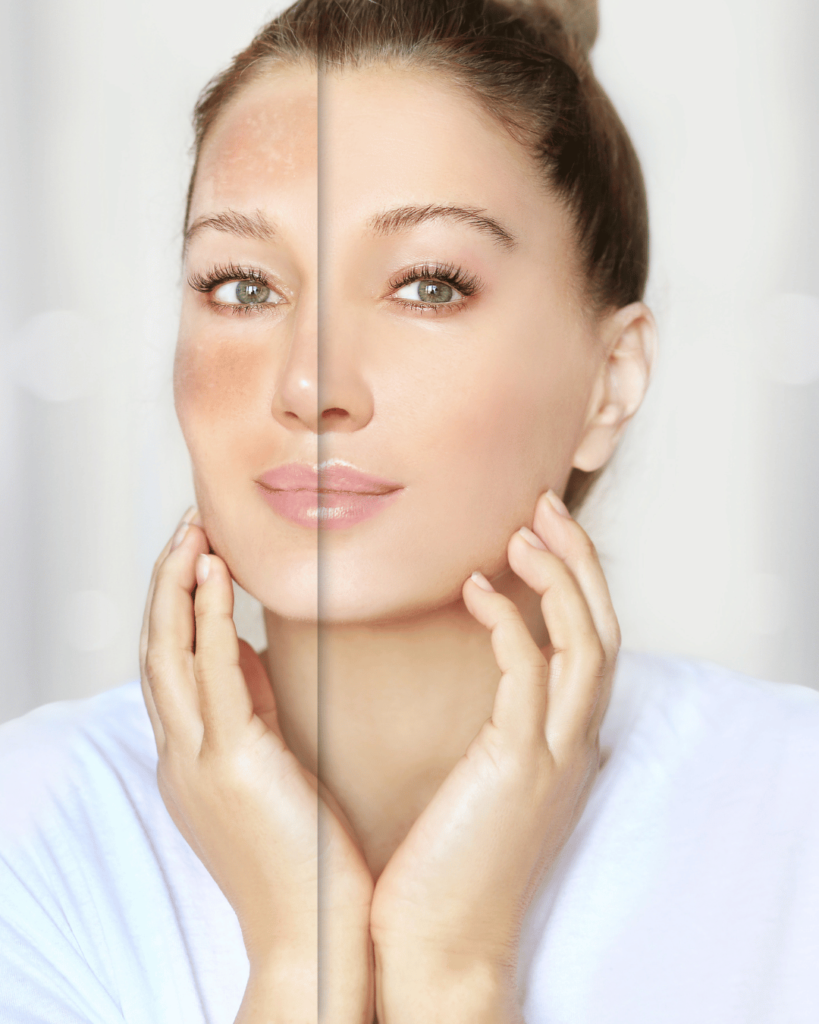 manchas en la piel dr jose becerra